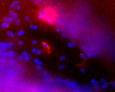 Imatge de fluorescència confocal d'una mostra de teixit nerviós de ratolí amb glioblastoma induït tractada amb immunofluorescència on s'observa un macròfag activat a causa de la presència del tumor.