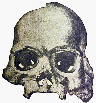 <span class="mw-page-title-main">Calaveras Skull</span> 1866 archaeological forgery in California