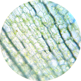 Elodea chloroplasts 400×