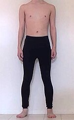 A man in compression tights Man in black tights.jpg