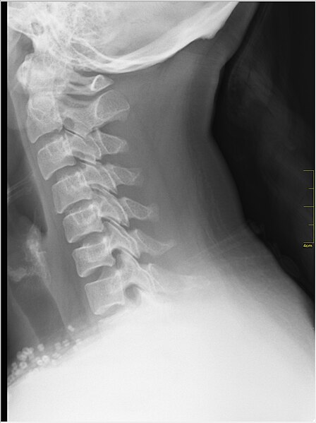 File:Medical X-Ray imaging EKZ04 nevit.jpg