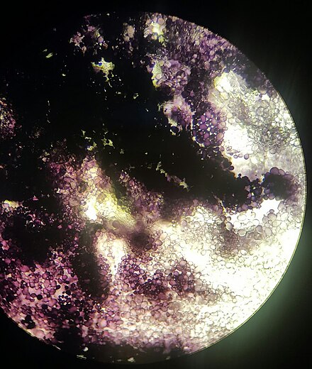 A thin section of a potato under light microscopy. It has been treated with an iodine based dye that binds to starch, turning it purple, showing the high starch content.