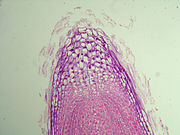 根の先端の顕微鏡写真