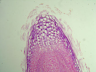 The growing tip of a fine root Root tip.JPG