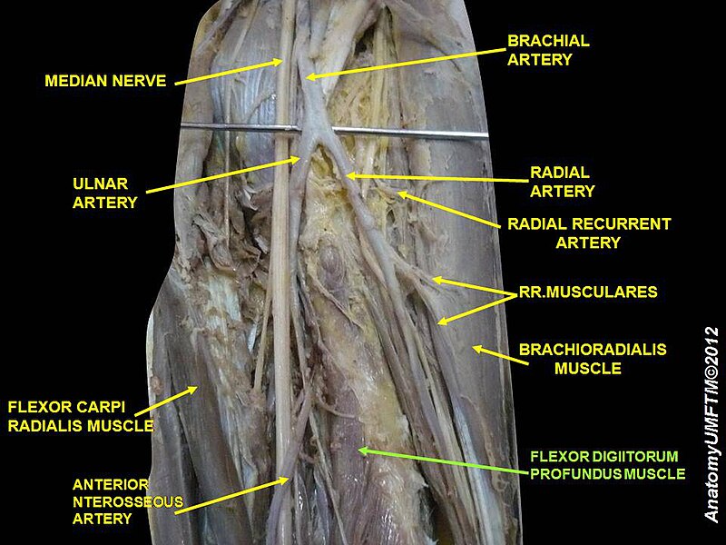 File:Slide3PPPP.JPG