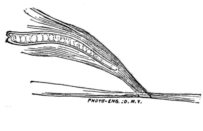 File:Trichinella spiralis (46).tif