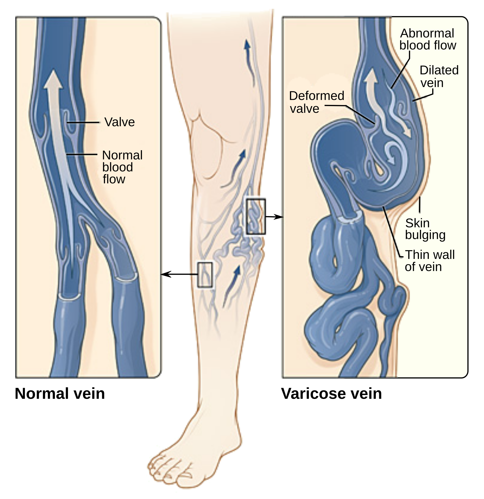 Leg Vein Chart