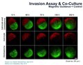 Astrocyte and Glioblastoma Invasion Assay performed after 3D culturing by MLM.tiff