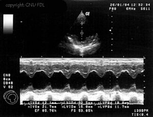 Sonografie: Anwendungen in der Medizin, Geschichte der Sonografie, Bildgebung