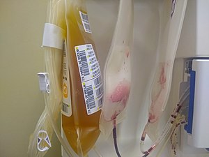 Convalescent plasma collected at a blood donor center during the COVID-19 pandemic. Convalescent plasma collected during COVID-19 pandemic.jpg