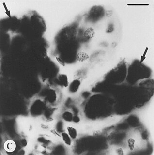 <span class="mw-page-title-main">Deer tick virus</span> Pathogenic member virus of Powassan virus