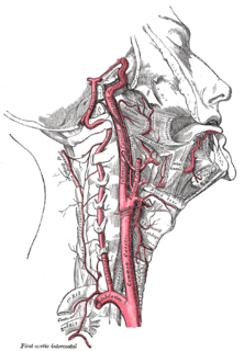 Carotid sinus the carotid sinus is a dilated area at the base of the internal carotid artery just superior to the bifurcation of the internal carotid and external carotid