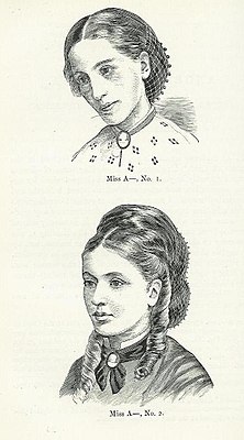 Девушка до лечения нервной анорексии (1866) и после лечения (1870) — иллюстрация из медицинских работ английского врача сэра Уильяма Галла (1816—1890).