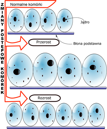 Rozrost