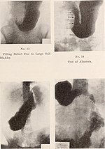 Thumbnail for File:Journal of roentgenology (1918) (14778029533).jpg