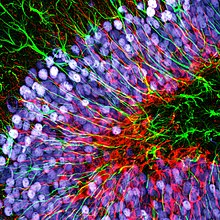 The hippocampus of a mouse imaged via fluorescence microscopy. Neuronal explosion.jpg