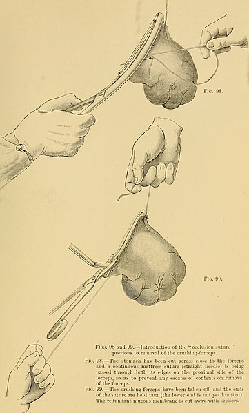 File:Text-book of operative surgery (1903) (14577700039).jpg