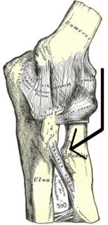 Radial tuberosity