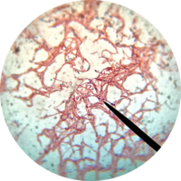 Sporulating B. subtilis.