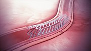 Miniatura para Stent bioabsorbible