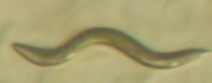 예쁜꼬마선충(Caenorhabditis elegans)