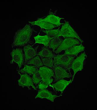 Cytokeratin 8 staining in the human breast cancer cell line MCF-7 Cytokeratin 8.jpg