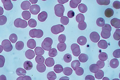 Ring forms in red blood cells (Giemsa stain)