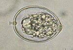 Miniatura para Phytophthora cinnamomi