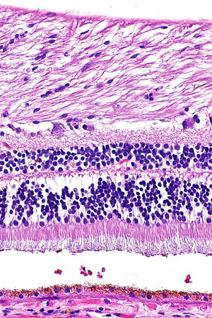 Netzhaut: Anatomie der Netzhaut des Menschen, Erkrankungen der Netzhaut, Acetylsalicylsäure