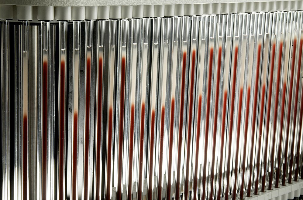 Erythrocyte Sedimentation Rate-avatar