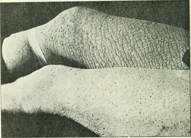 File:The British journal of dermatology (1888) (14770779252).jpg