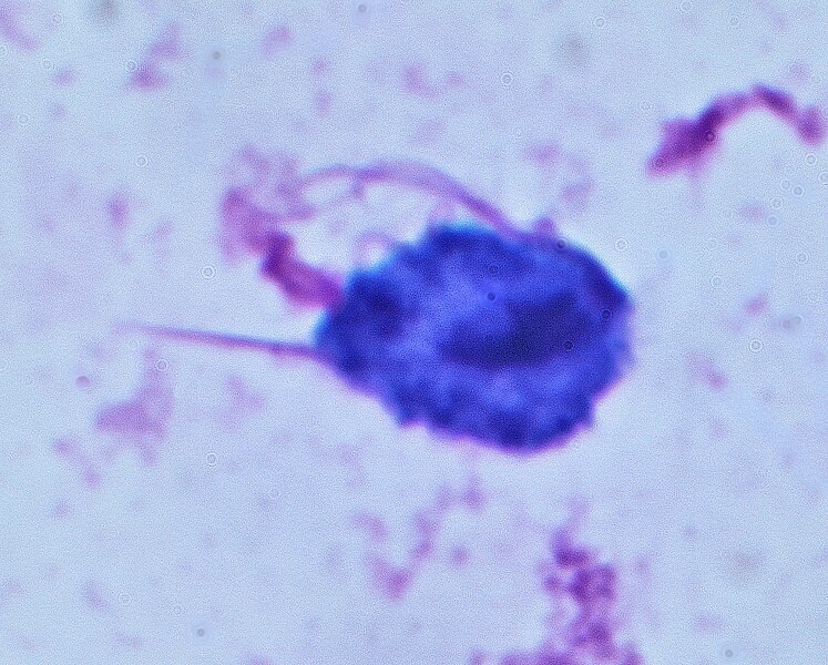File:Trichomonas vaginalis May-Grünwald-Giemsa staining.jpg