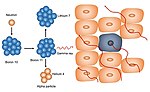 Thumbnail for Neutron capture therapy of cancer