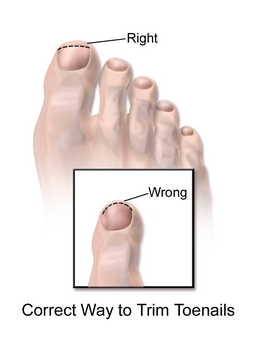 Foot Care Trim Nails