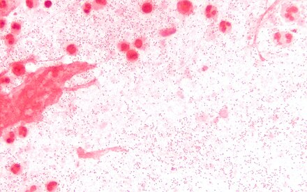 Haemophilus influenzae b. Гемофильная палочка Пфайфера. Гемофильная инфлюэнца. Бактерии Haemophilus influenzae. Haemophilus influenzae микробиология.