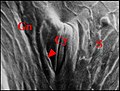 Fig.6 - Leptoneta microphtalma, orifice de la glande rétrognathocoxale dans une crypte (Cy), surmontée d'une languette (flèche), entre le sternum (S), la gnathocoxa (Cn) et la hanche de PI (en bas et à gauche).