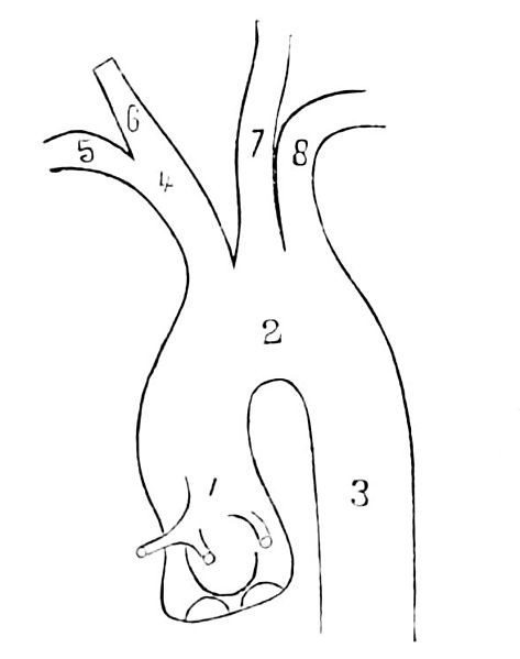 File:PSM V23 D096 Left carotid artery versus the right.jpg
