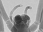 (permission) Phase-contrast x-ray image of spider