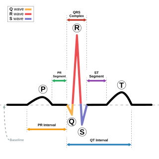 <span class="mw-page-title-main">Electrocardiography</span> Examination of the hearts electrical activity