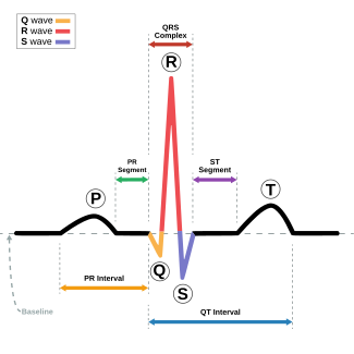 Ecg Chart