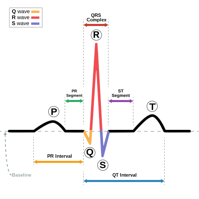 Schematic representation of a normal ECG trace showing sinus rhythm; an example of widely used clinical medical equipment (operates by applying electronic engineering to electrophysiology and medical diagnosis).