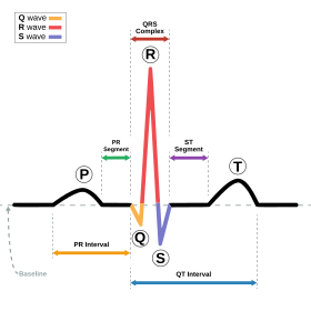 SinusRhythmLabels.svg