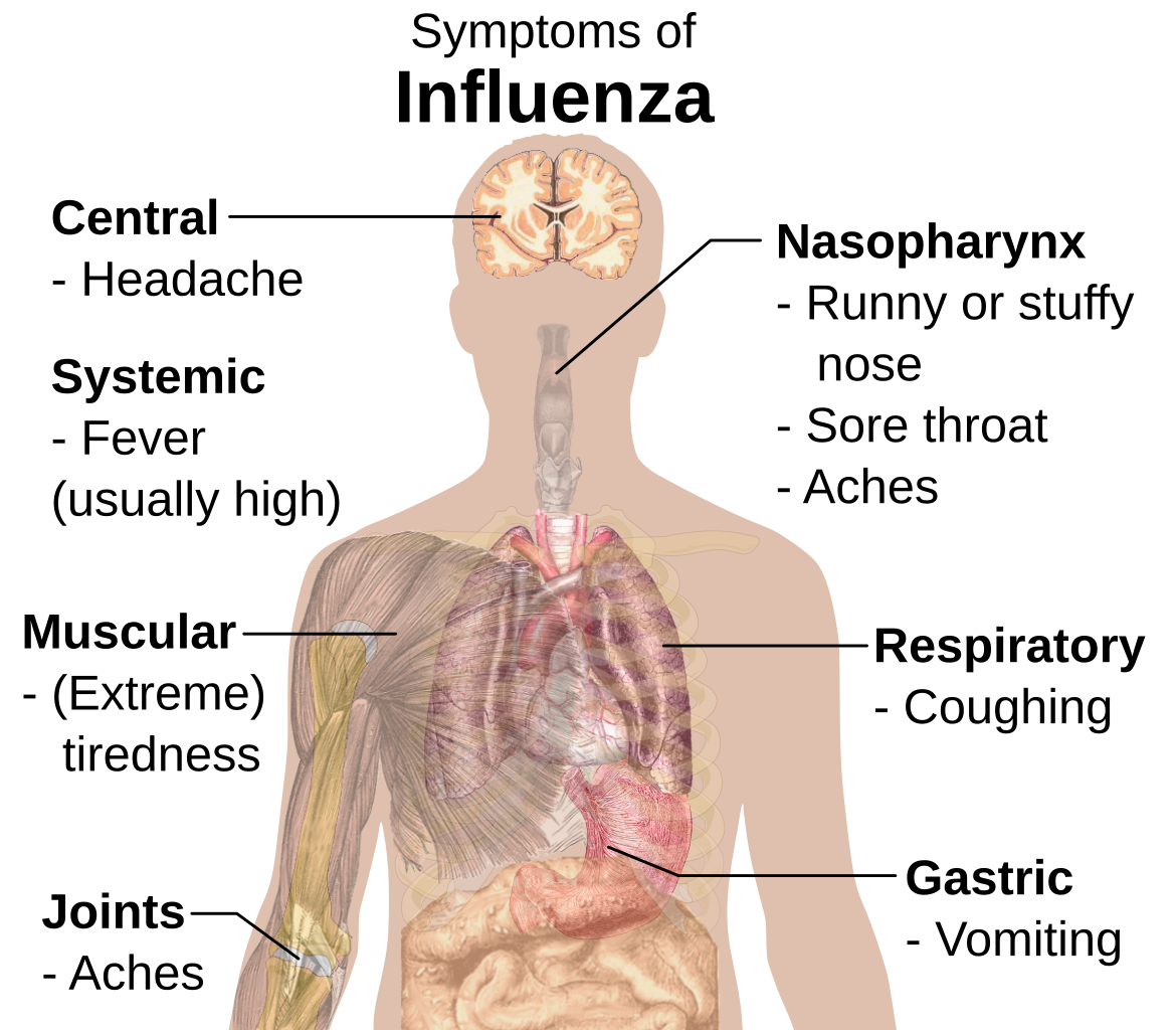 File:Symptoms of influenza.svg - Wikimedia Commons