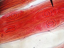 Trichinella spiralis larvae in uncooked pig meat Trichinella spiralis larvae within muscle.jpg