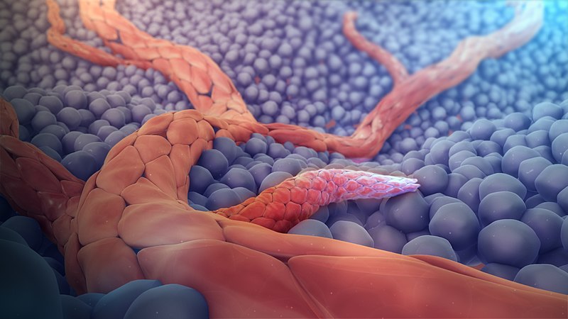 File:Angiogenesis medical animation still.jpg