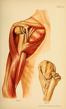 Fracture de l'extrémité supérieure de l'humérus — Wikipédia