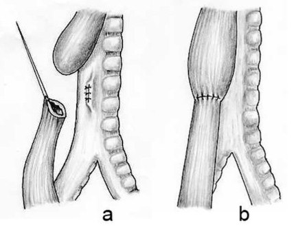 Schematic representation