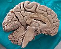 Human Brain Dissected.jpg