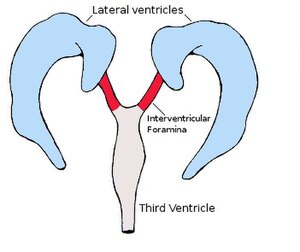 Interventricularforamina.jpg
