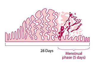 Menstrual disorder